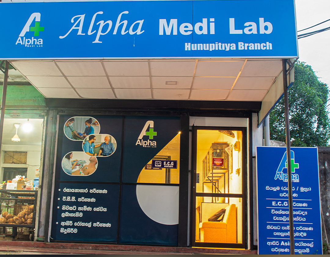 Hunupitiya Branch